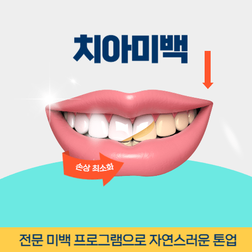 정읍치과 정읍시 치과 치아미백