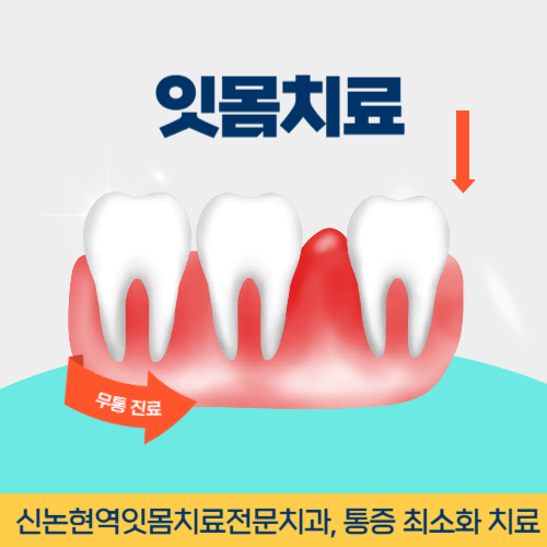 정읍치과 정읍시 치과 잇몸치료